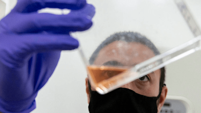 Investigadores estudian péptidos que  ayudarían a optimizar vacunas contra tuberculosis