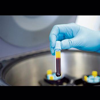 UN TEST DE SANGRE ABRE LA VÍA A LA DETECCIÓN DE OCHO TIPOS DE CÁNCER