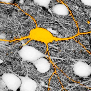 DESARROLLAN UNA REVOLUCIONARIA TÉCNICA DE MICROSCOPÍA QUE PERMITE VISUALIZAR TODAS LAS CÉLULAS DE UNA REGIÓN CEREBRAL