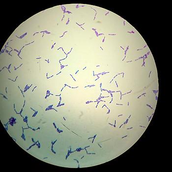 Bacterias favorecerían crecimiento de caña panelera