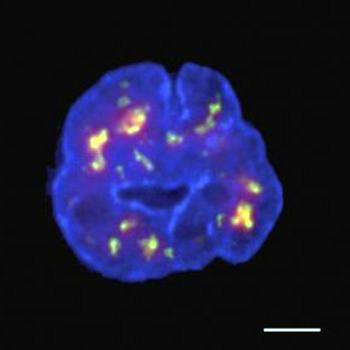Investigadores desarrollan una nueva técnica para construir un mapa 3D del genoma humano