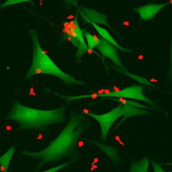 Hacia una terapia ultrapersonalizada para el tratamiento del melanoma