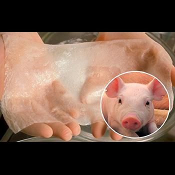 Primera aplicación de piel de cerdo genéticamente modificada en herida humana