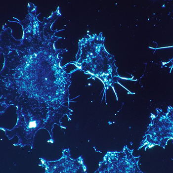 El mayor estudio genómico de cáncer abre la puerta a su detección precoz